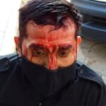 Vergüenza en Salta: atacan a piedrazos a policías que querían frenar un campeonato barrial